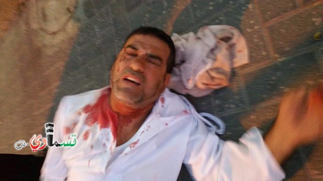 اللد : عماد أبو شرخ  مستوطنون اعتدوا عليّ بصورة وحشية